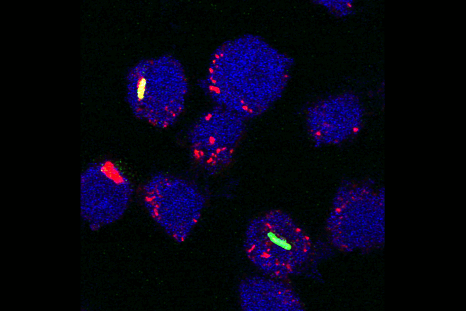 Overlay confocal microscopy image of macrophages (blue) infected with tuberculosis vaccine strain Mycobacterium bovis BCG (green). Acidic compartments (lysosomes, phagolysosomes) are stained in red. Co-localization of bacteria with acidic compartments is indicated by yellow.