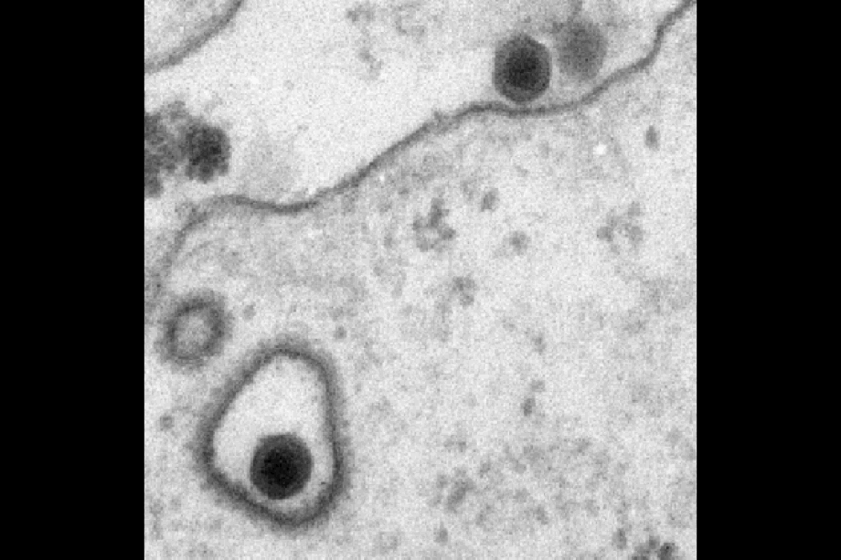 Electron micrograph thin section of a human cell infected with adenoviruses. The virus (dark structure) in the upper part of the image is located on the plasma membrane (thin wavelike line) outside the cell. The virus in the lower part of the image is located in a clathrin-coated endosome (the dark line representing the endosomal membrane, and peripheral spike-like structures in light grey the clathrin coat). The diameter of a virus is about 0.1 micrometer.