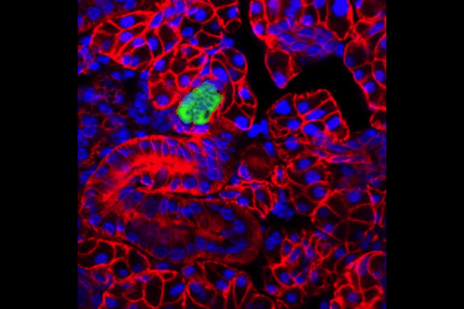 Tissue section of a salivary gland 4 weeks after infection with murine cytomegalovirus (MCMV). Red: Cell membranes; green: MCMV infected cell; blue: cell nuclei.