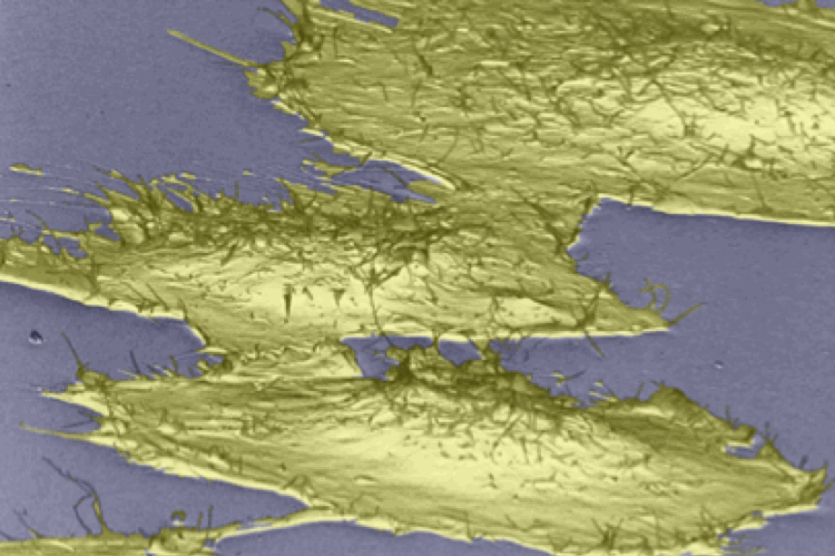<p align="left"><strong>Surface scanning electron micrograph of three human cells (yellow depicting the plasma membrane) on a flat substratum (blue). </strong>Note that the cells are connected to each other at regions of cell-cell contacts. The heightened center of each cell depicts the location of the cell nucleus underneath the plasma membrane.</p>